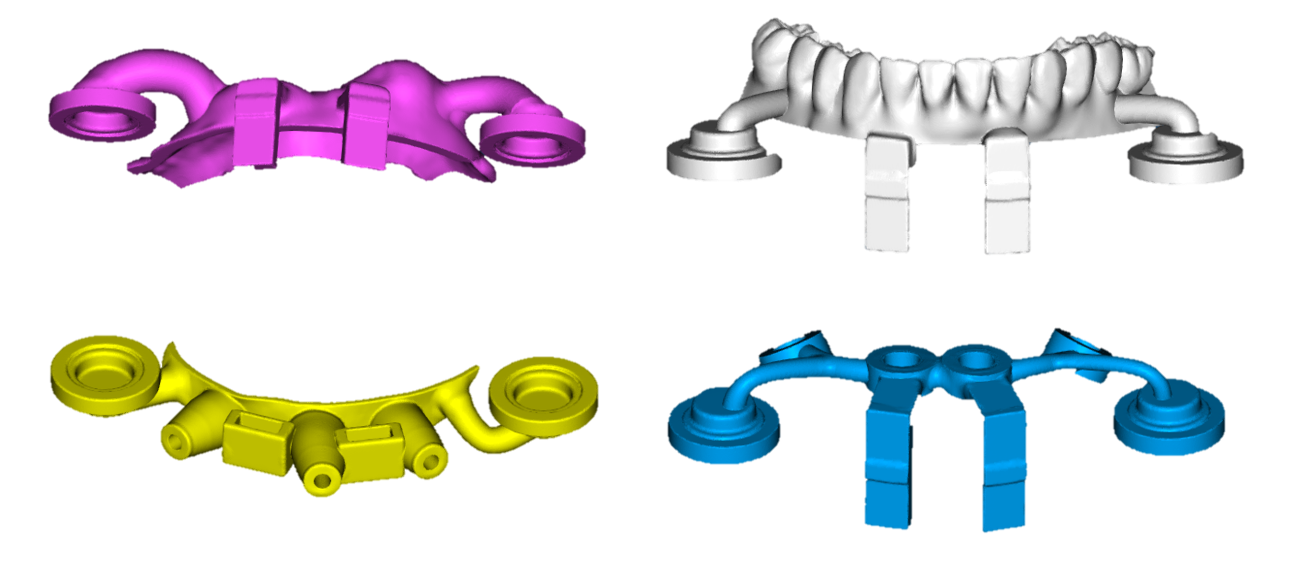 Implant Stackable Guide